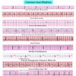 12 Lead EKG Pocket Card APRN World 9781941004067 Amazon Books