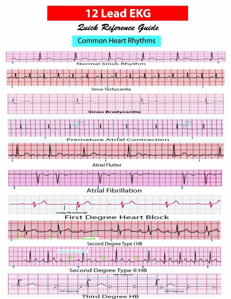 12 Lead EKG Pocket Card APRN World 9781941004067 Amazon Books