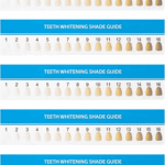 Teeth Whitening Shade Guide Download Printable PDF Templateroller